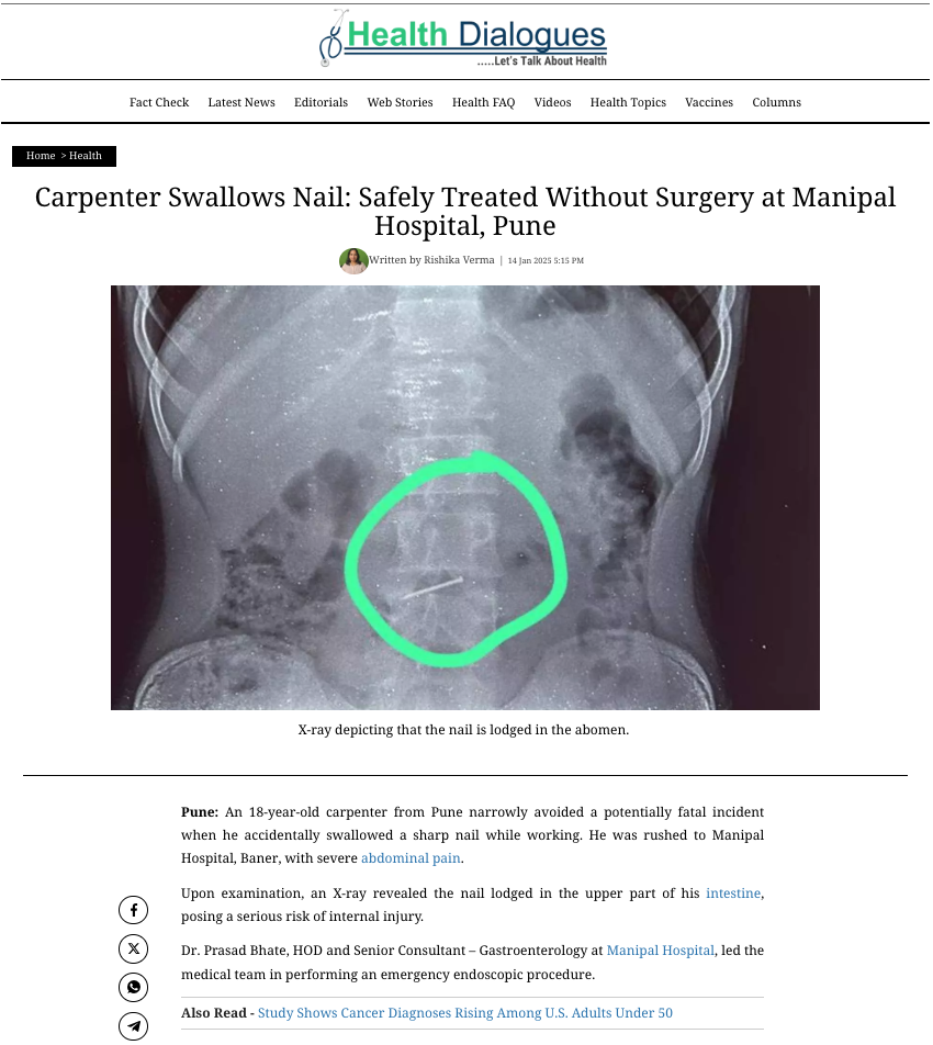 Carpenter Swallows Nail: Safely Treated Without Surgery at Manipal Hospital, Pune
