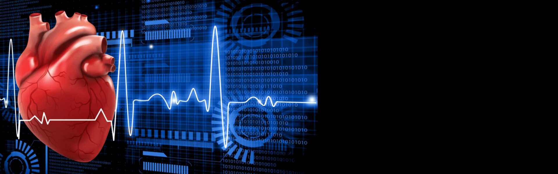 Myocardial Infusion Scan Pharmacological Stress-Instructions in Baner, Pune