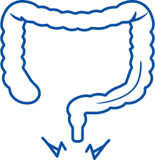 Anal Fissure Treatment in Bhubaneswar | Manipal Hospitals