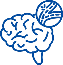 Stroke Rehabilitation in Bhubaneswar | Manipal Hospitals