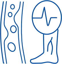 Varicose Veins Treatment in Bhubaneswar | Manipal Hospitals