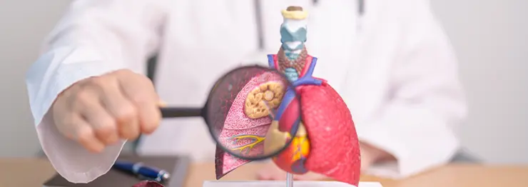 Lung Cancer Treatment in Kolkata