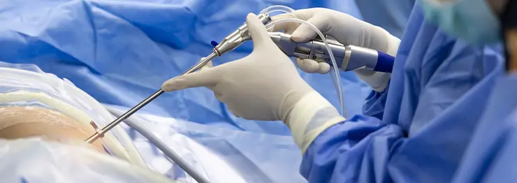 Tavi Heart Procedure in Kolkata