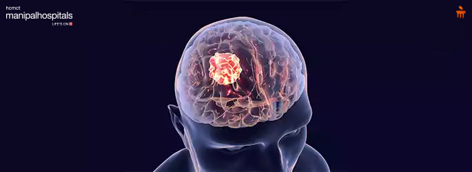 Neurology Hospital In Delhi