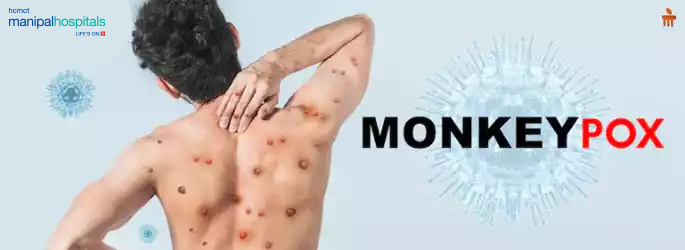 Infectious Disease Treatment Hospital in Delhi