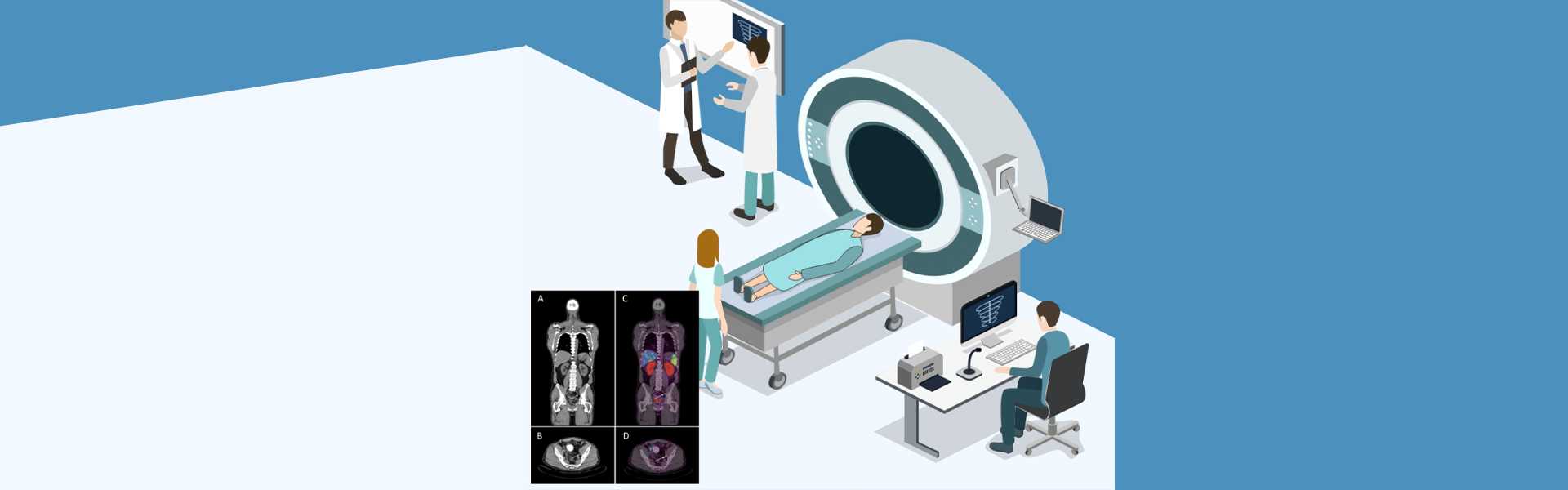 Nuclear Medicine - PSMA PET-CT Scan in Delhi