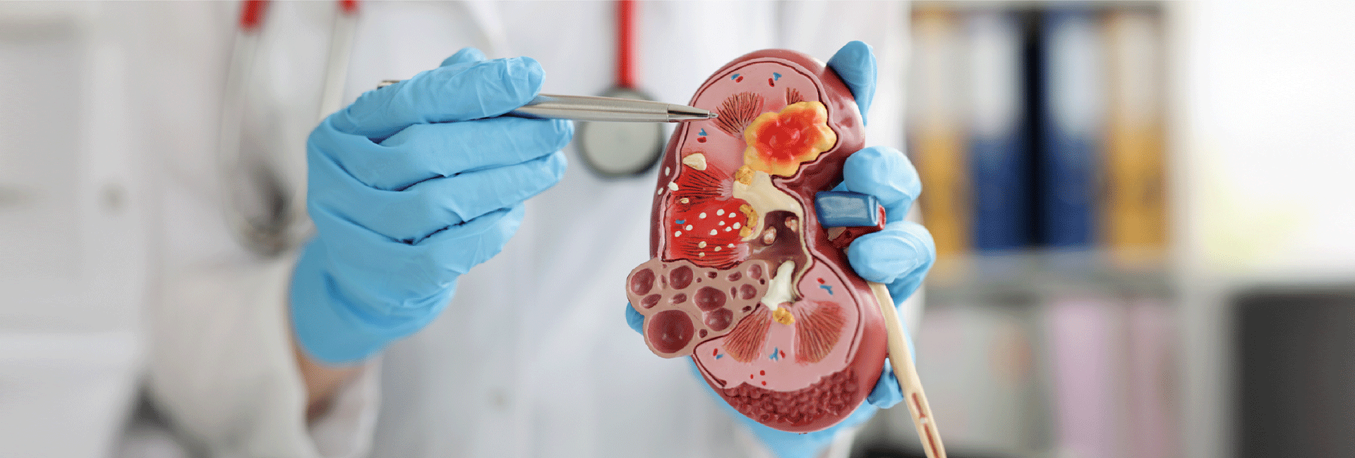 Best Kidney Hospital in Delhi