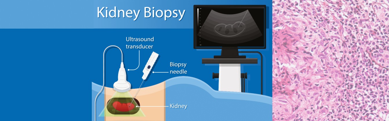 Kidney specialist in Goa