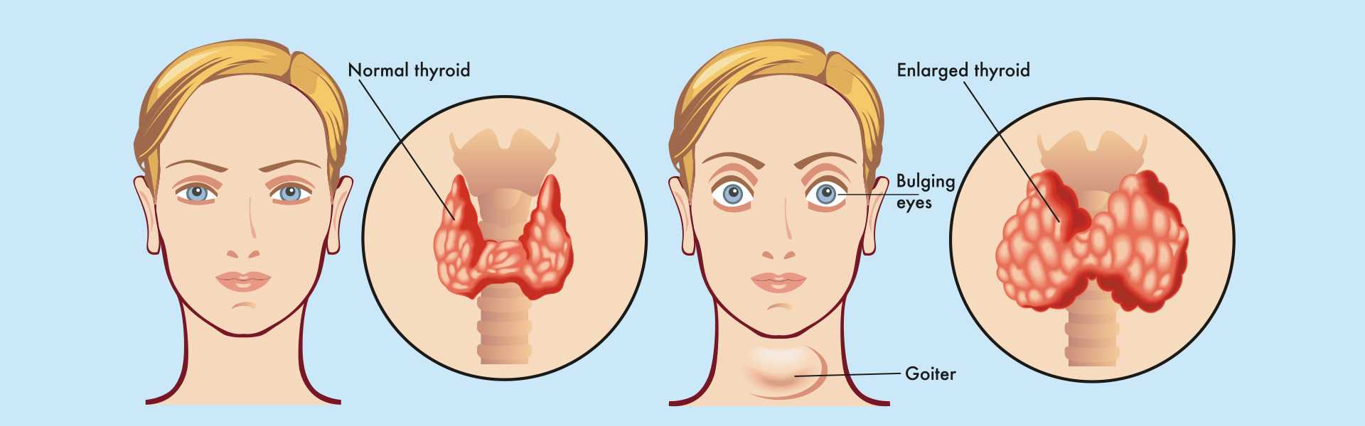 Thyroid Imaging in Goa