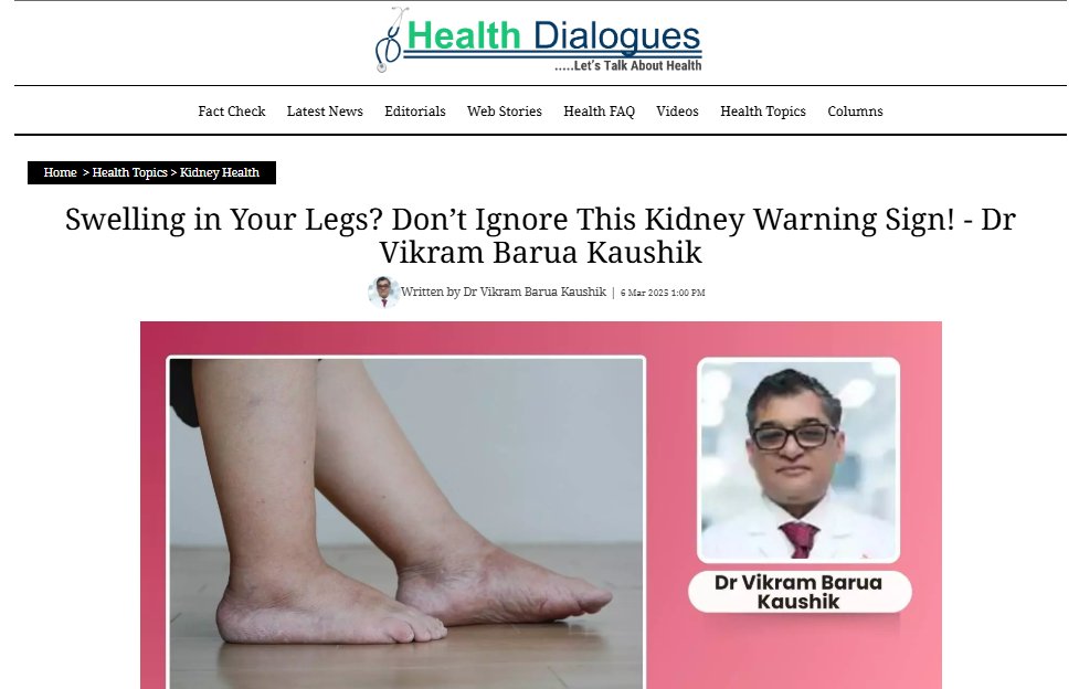 Swelling in Your Legs