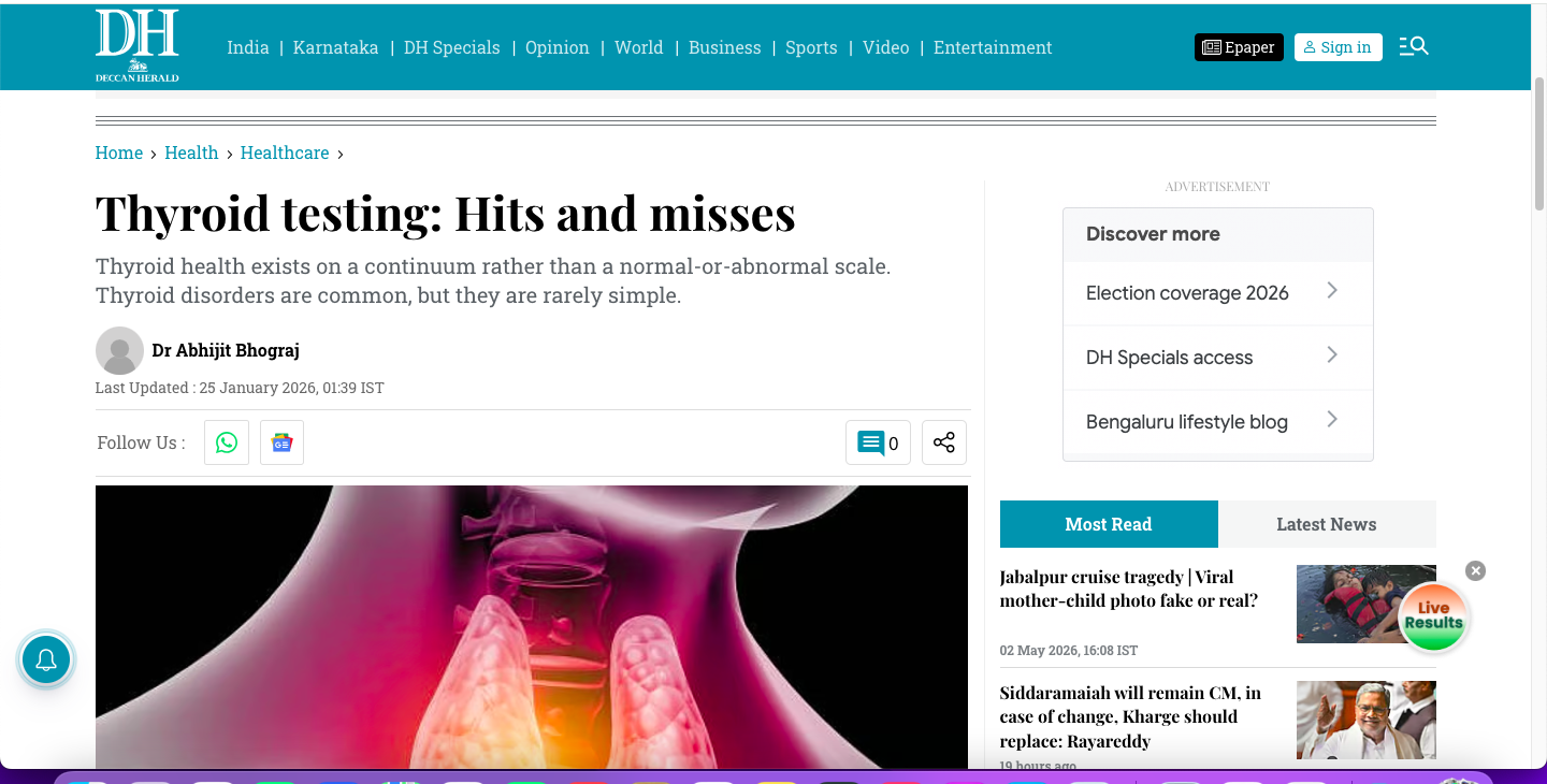 Thyroid testing: Hits and misses