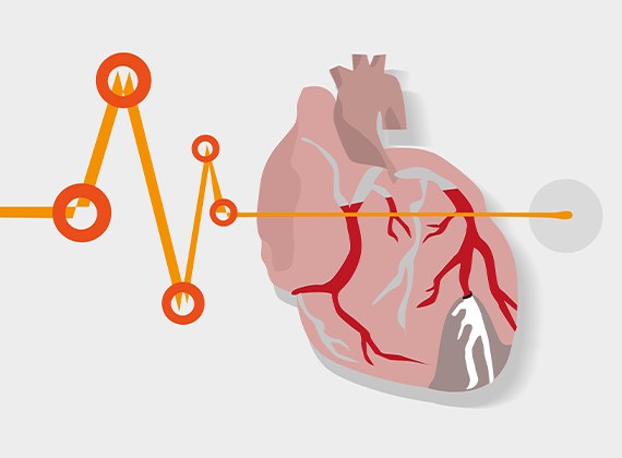 Heart Failure Clinic in Bangalore