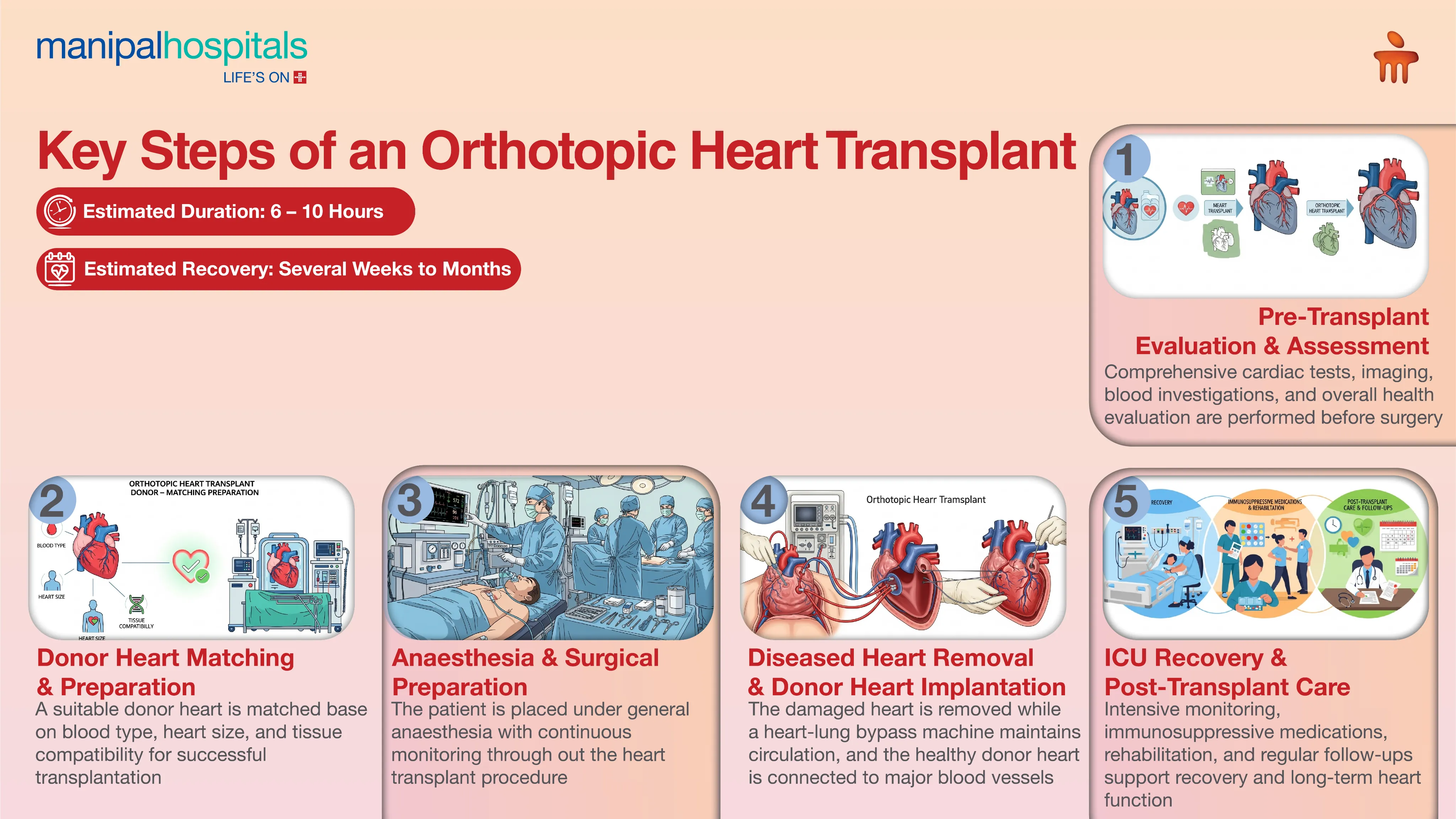 Advanced Heart Transplant in Jaipur | Manipal Hospitals