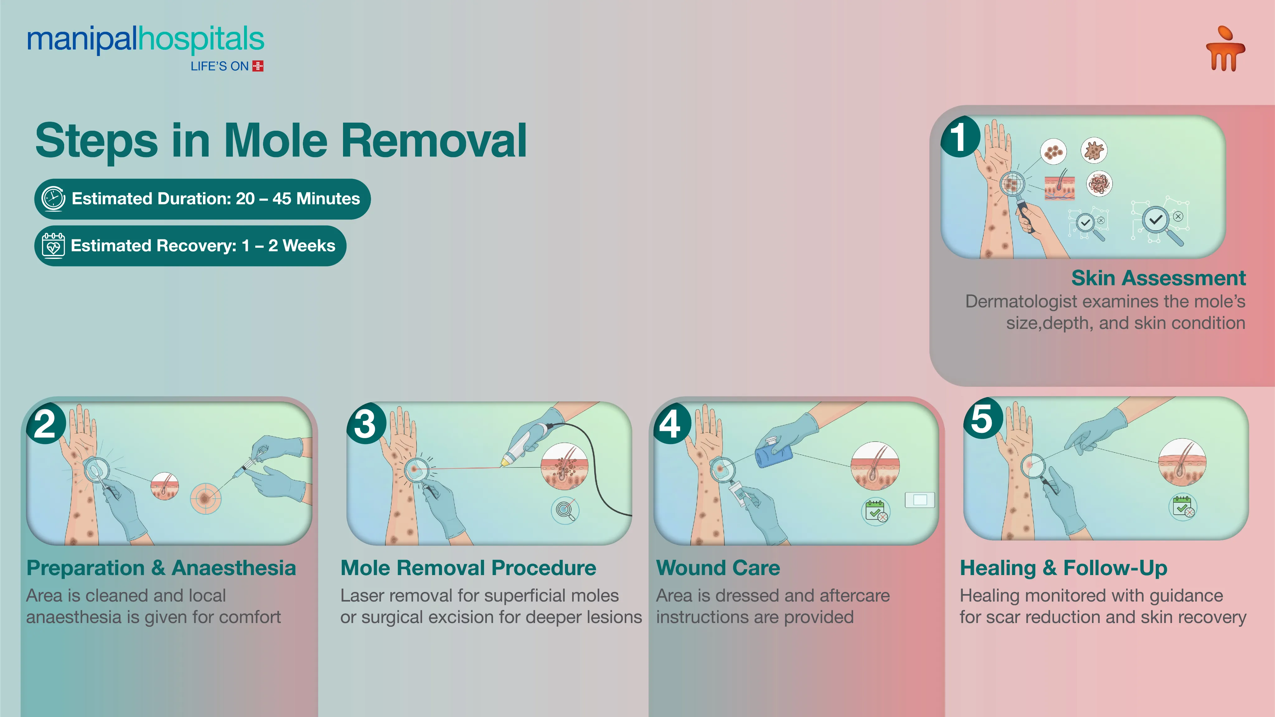 Laser Mole Removal in Jaipur | Manipal Hospitals