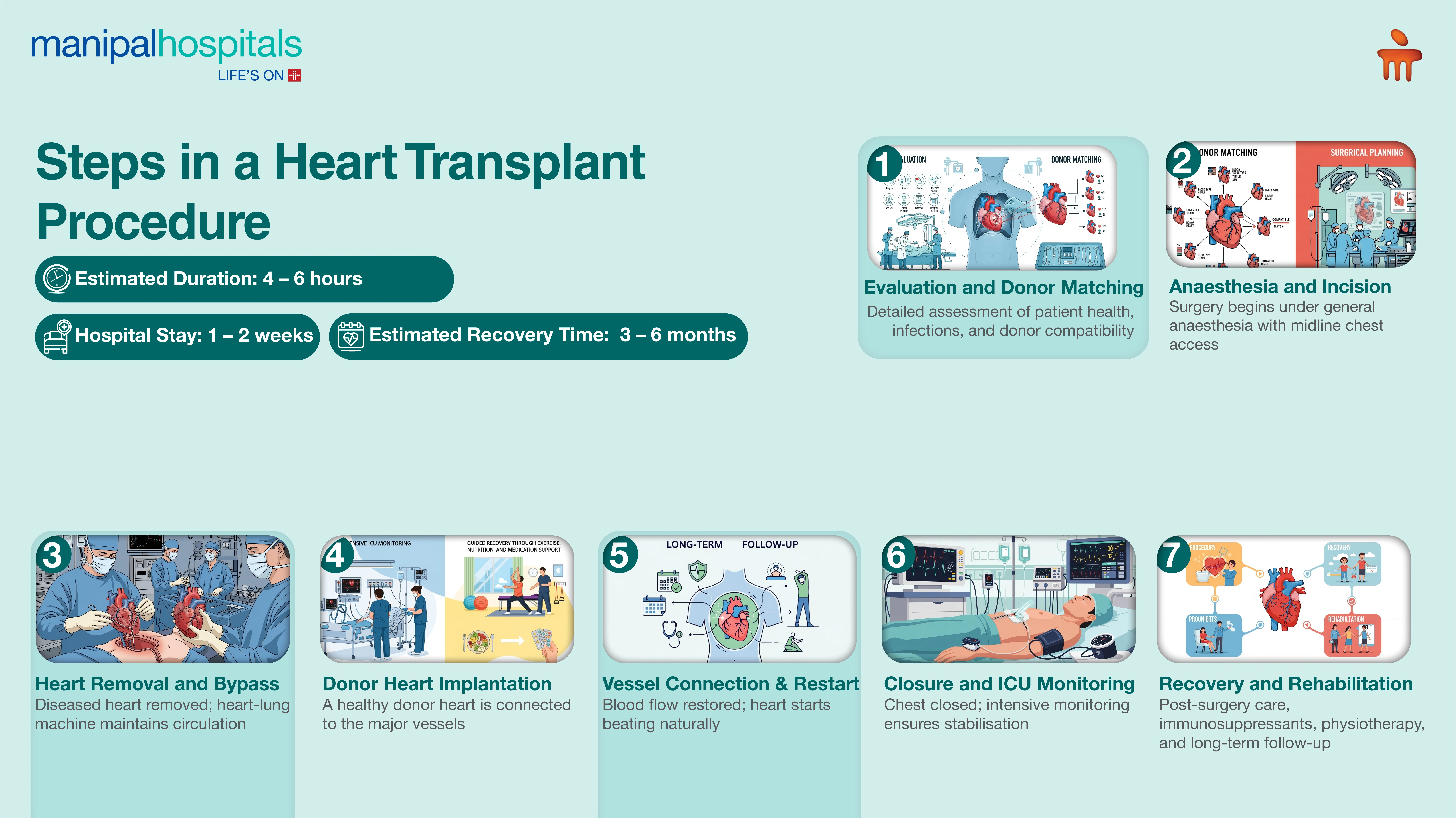 Advanced Heart Transplant in Jaipur | Manipal Hospitals