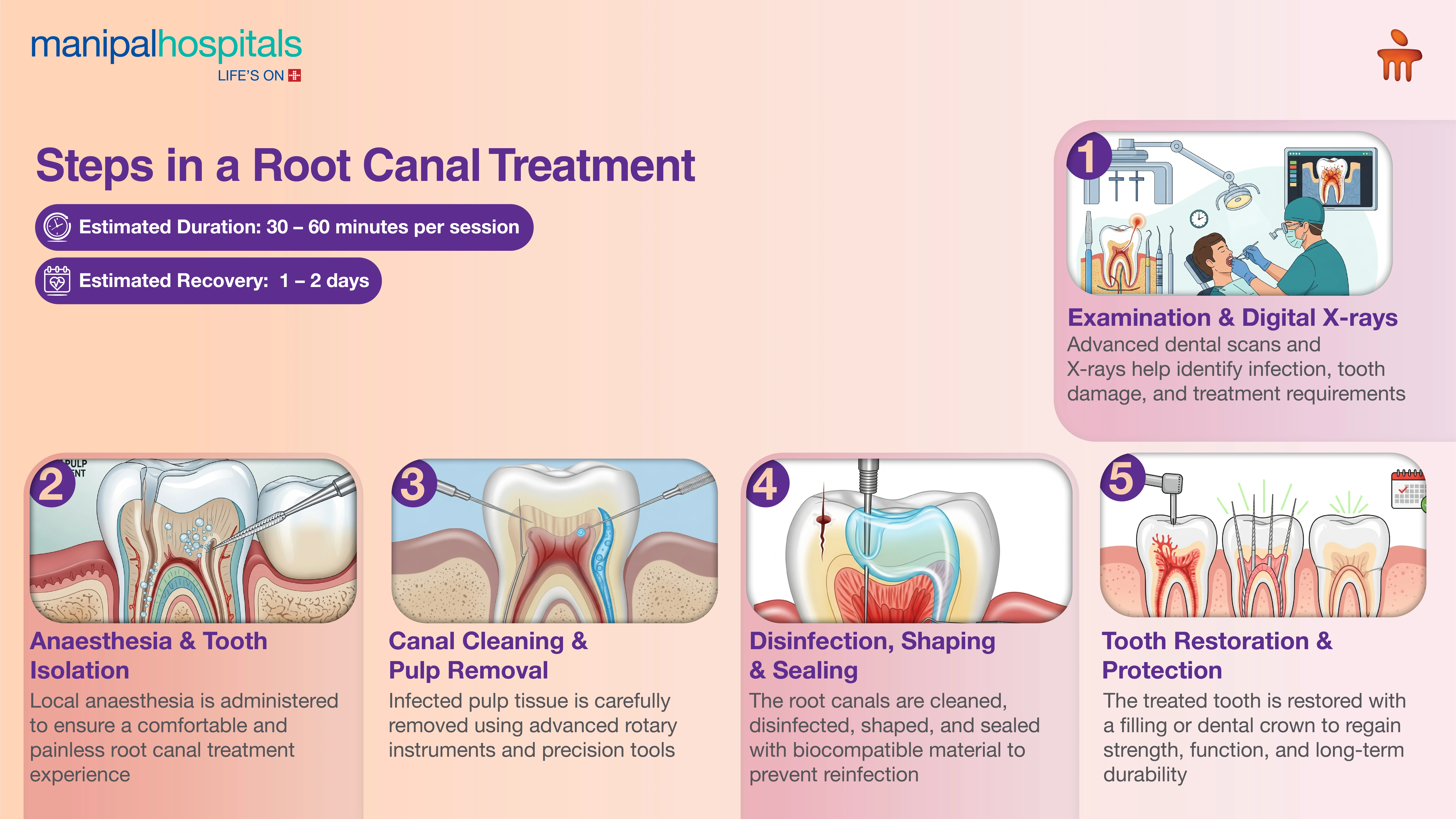 Best Root Canal Treatment in Jaipur | Manipal Hospitals