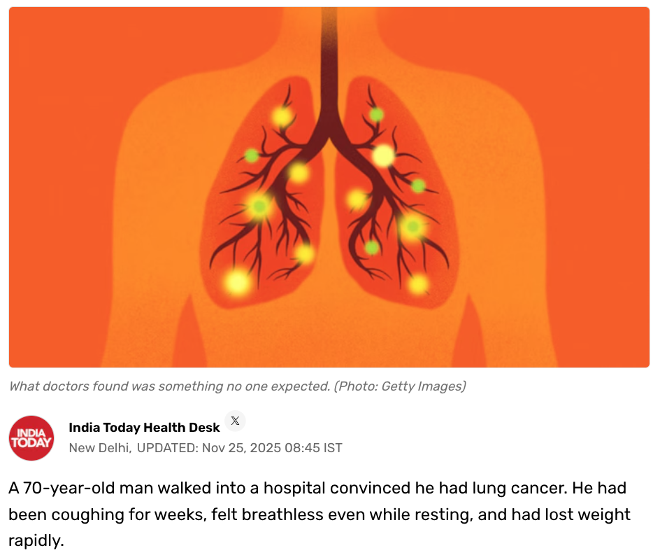 He thought it was lung cancer