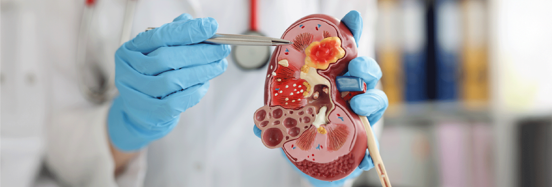 Kidney Treatment Hospital in Pune