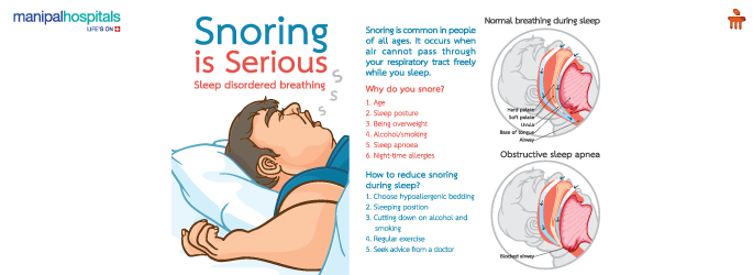 Sleep Apnea and Snoring Treatment in Malleshwaram