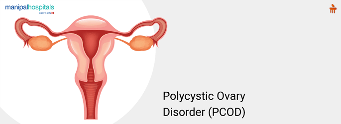 Polycystic Ovarian Syndrome Treatment in Mangalore