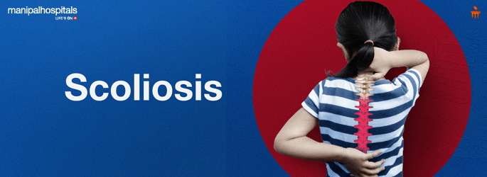 Idiopathic Scoliosis Treatment in Mangalore