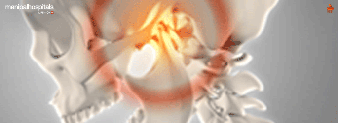 Temporomandibular joint Disorders treatment in Mangalore