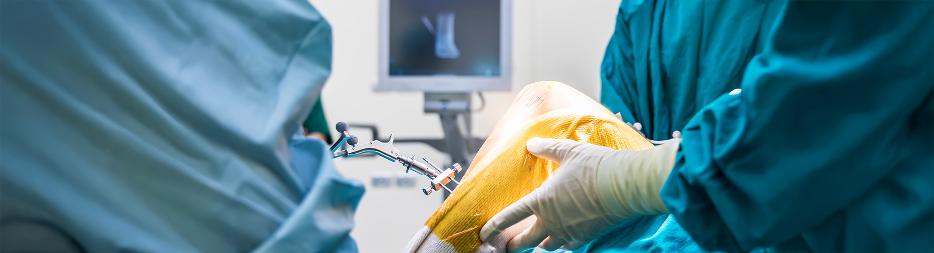 CUVIS Robotic System | MIJRRS Manipal Hospitals