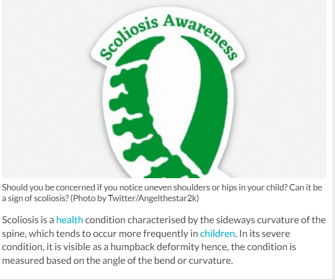 Spine surgeon in Bangalore