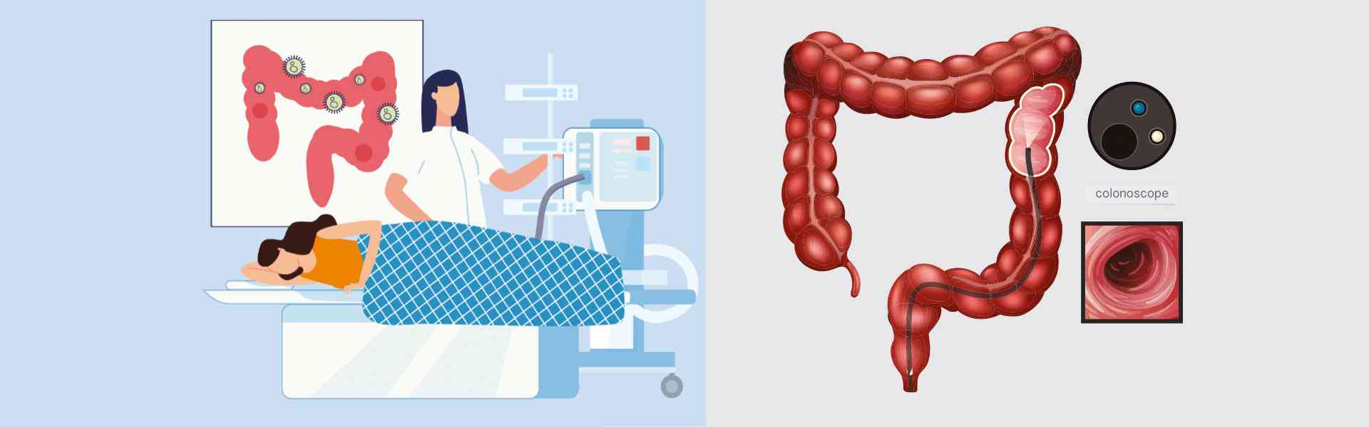 Colonoscopy Test Centre in Millers Road