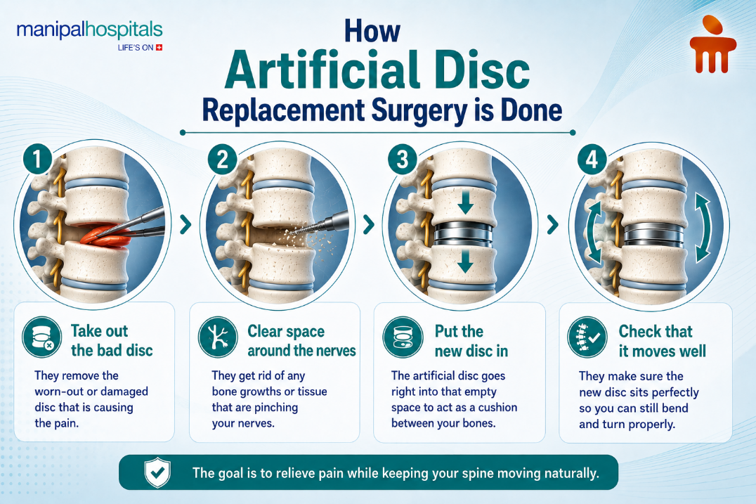 artificial-spinal-disc-replacement