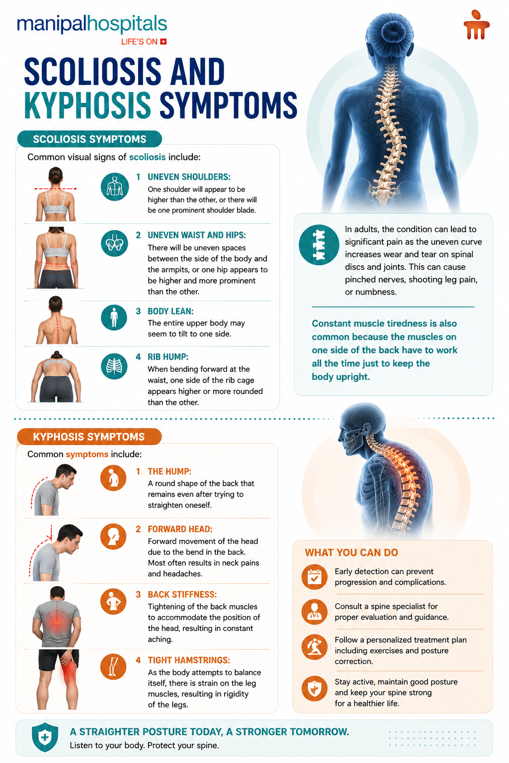 kyphosis-vs-scoliosis