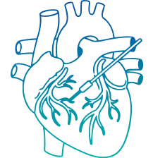 Coronary Angiography in Mysore | Manipal Hospitals