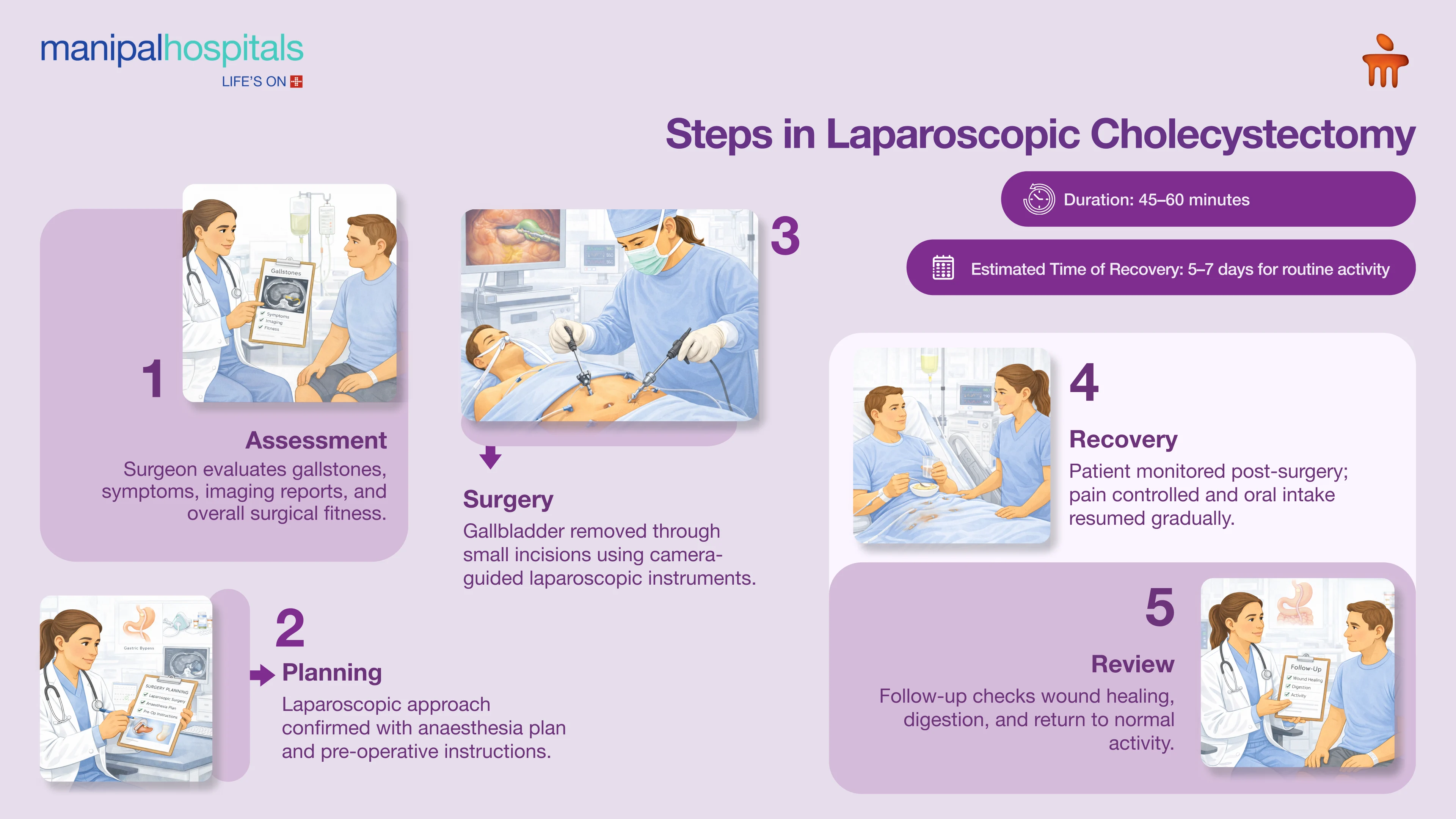 Laparoscopic Gallbladder Removal in Mysore | Manipal Hospitals