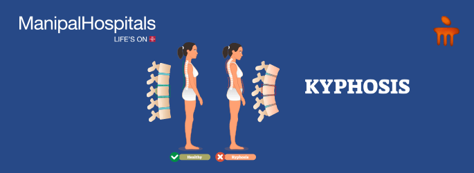 spine treatment in Bangalore