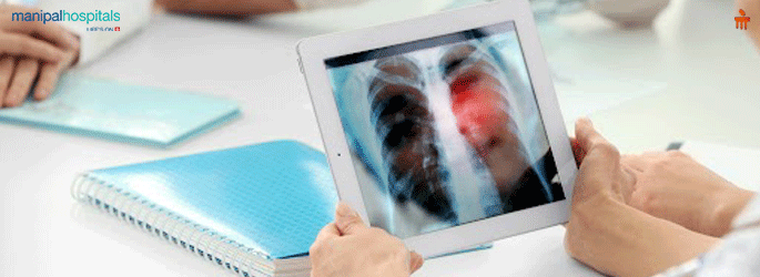 Cancer care hospital in Bangalore