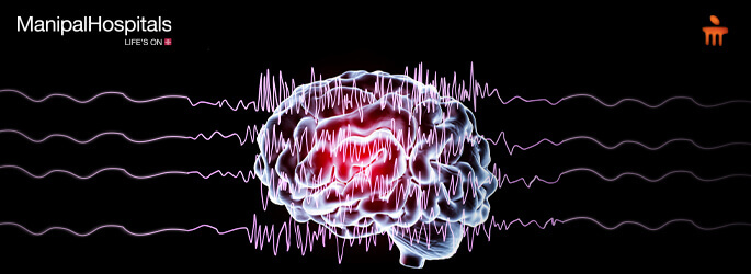 best neurologist in Bangalore