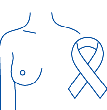 Breast Cancer Treatment in Patiala | Manipal Hospitals