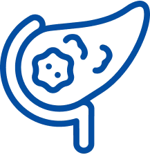 Gallbladder Stone Surgery in Ranchi | Manipal Hospitals