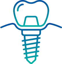 Dental Implants in Ranchi | Manipal Hospitals