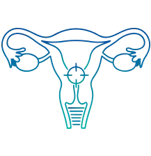 Gynecological Screening in Salem | Manipal Hospitals