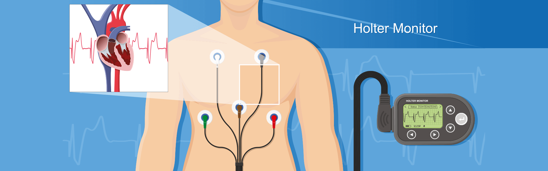 Holter Procedure Hospital in Salem