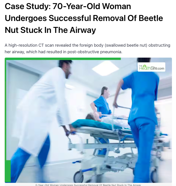 Dr Suhas H S on Case Study: 70-Year-Old Woman Undergoes Successful Removal Of Beetle Nut Stuck In The Airway