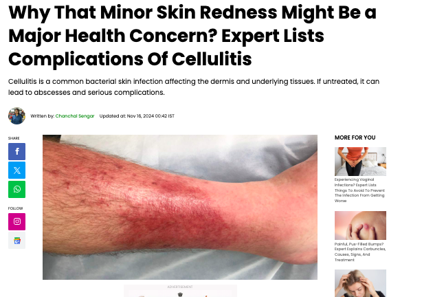 Why That Minor Skin Redness Might Be A Major Health Concern? 