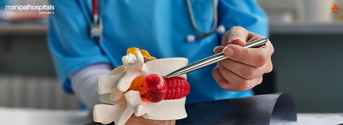 Acid Reflux vs GERD: When It Stops Being Mild and Needs Medical or Surgical Care