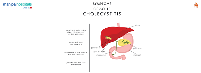 Acute Cholecystitis: Causes, Symptoms & Treatment