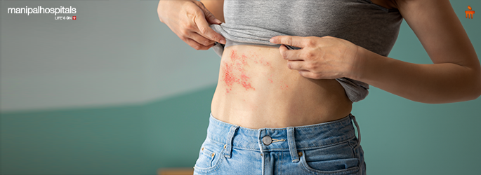 All You Need to Know About Shingles: Required Vaccination, Risks and Symptoms