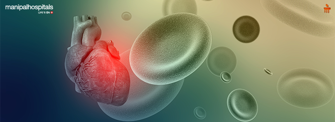 Angiogram Explained: Your Guide to Procedure, Benefits, and Recovery at Manipal Hospitals