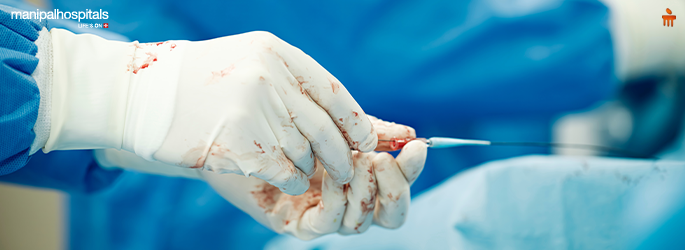 What Is Angioplasty? Procedure, Risks & Recovery