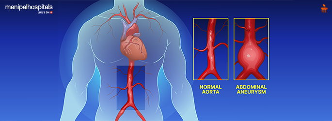 Aortic artery health check