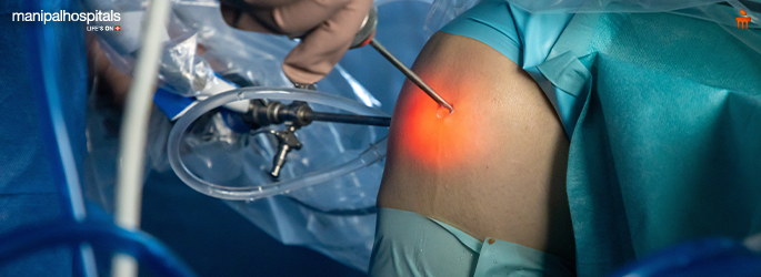 Arthroscopy Surgery: Benefits, Procedure, Recovery Time & Success Rate arthroscopy surgery